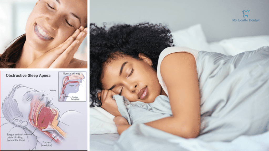 Reasons You Should Get a Night Mouth Guard to Protect Your Teeth Reasons You Should Get a Night Mouth Guard to Protect Your Teeth