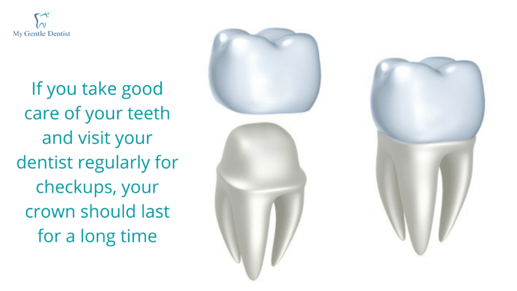 What are Dental Crowns and Bridges?
