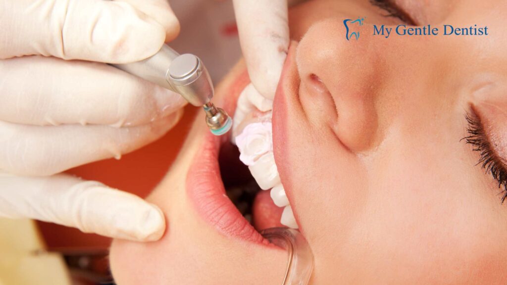 The Benefits of Dental Sealants: Protecting Your Teeth from Tooth Decay Dental Sealants