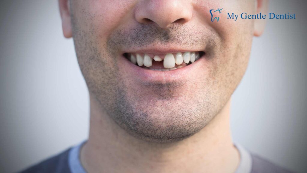 Top 5 Reasons to Choose a Dental Crown for Damaged Teeth Damaged Teeth