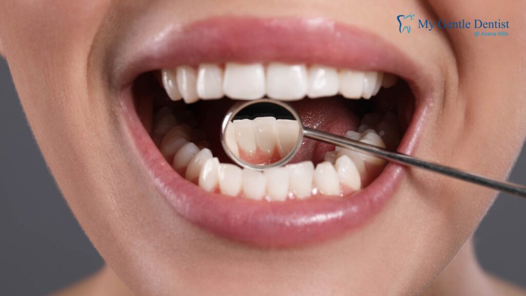 Non-Surgical vs Surgical Treatment for Gum Disease: What You Should Know What Is Gum Disease