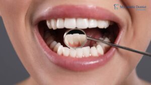 Non-Surgical vs Surgical Treatment for Gum Disease: What You Should Know Gum Disease