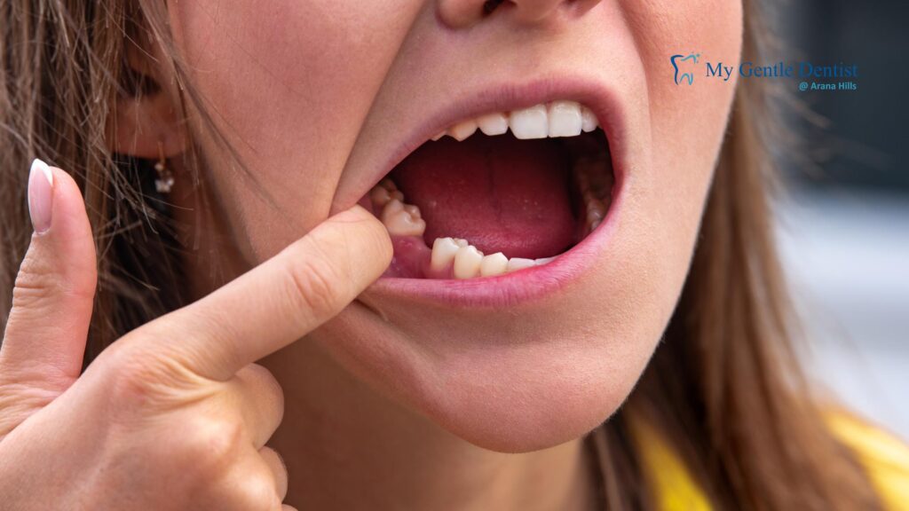 Why Seeing Periodontists Near Me Early Could Prevent Tooth Loss Why Seeing Periodontists Near Me Early Could Prevent Tooth Loss