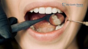 Wisdom Teeth Removal Cost vs Long-Term Dental Health: Is It Worth Delaying Wisdom Teeth Removal Cost