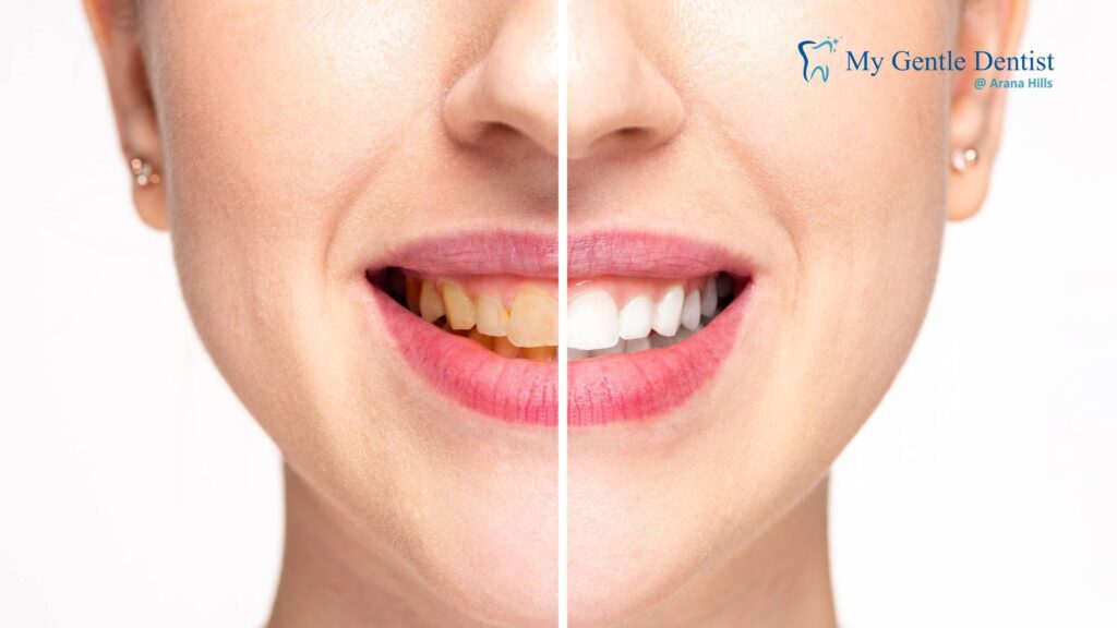 Benefits of a Cosmetic Makeover