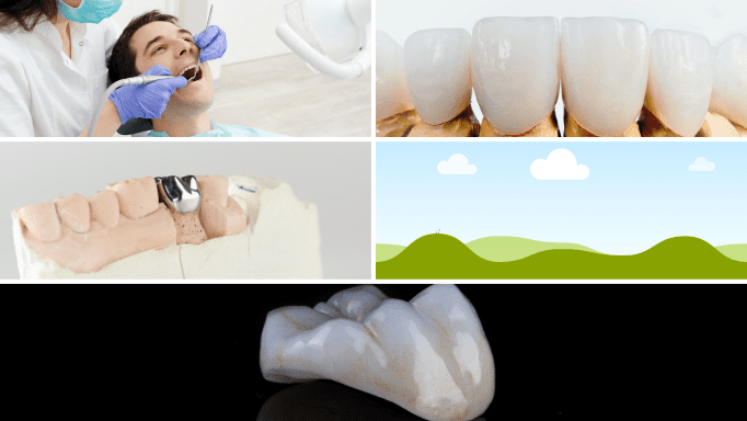 Tooth Wear: Causes, Prevention, and Treatment