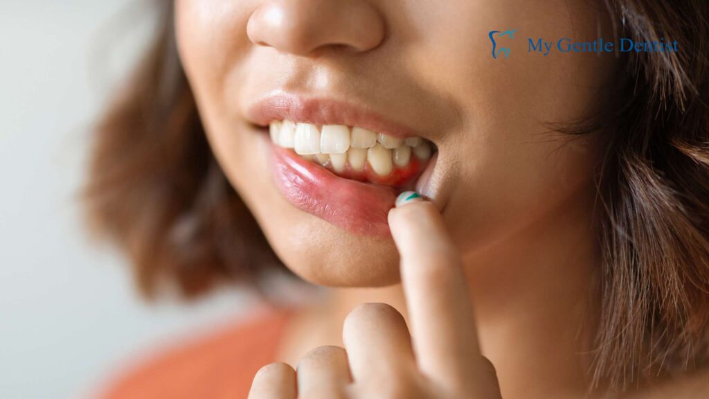 10 Common Symptoms of Gingivitis and How to Address Them