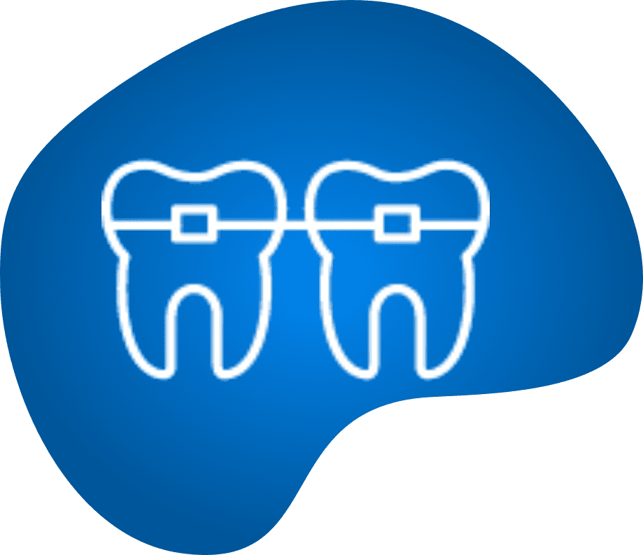 braces