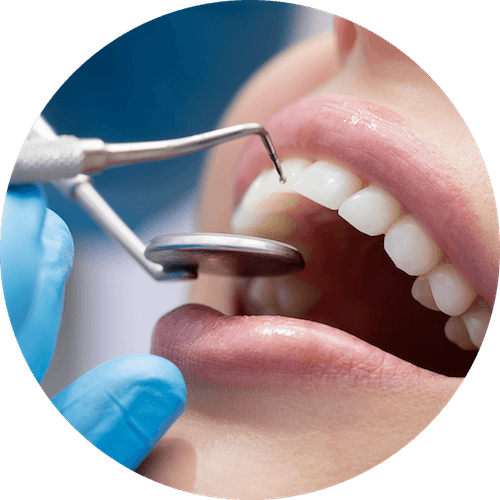 My Gentle Dentist Aranahills