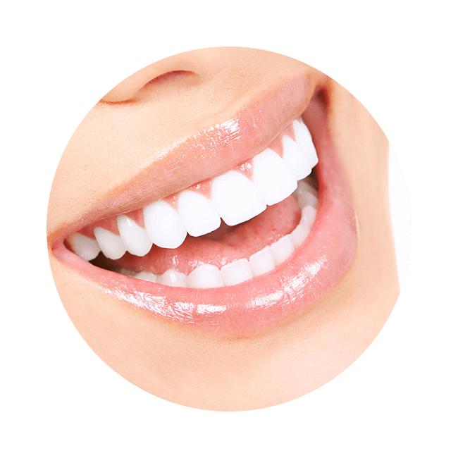 My Gentle Dentist Aranahills