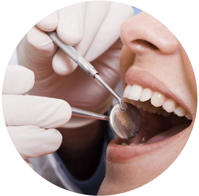 Wisdom Tooth Surgery
