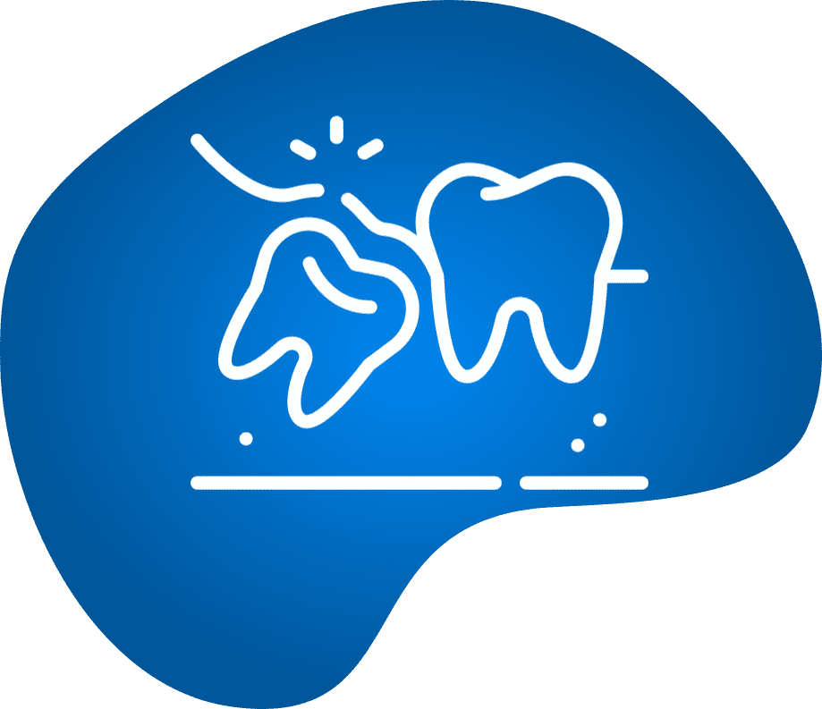wisdom tooth