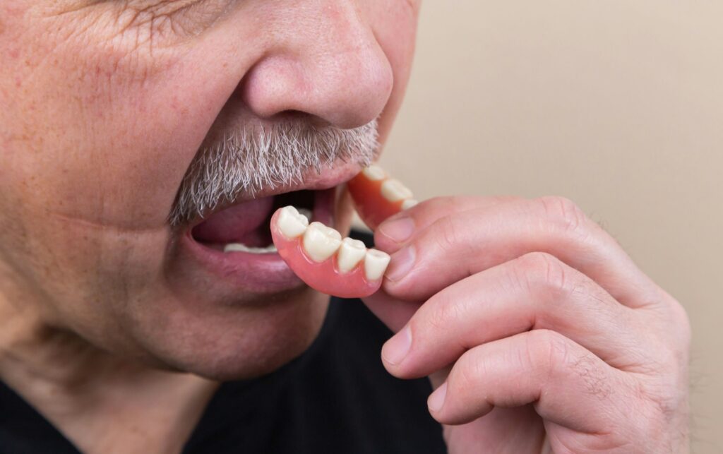 Dental Crown & Bridges