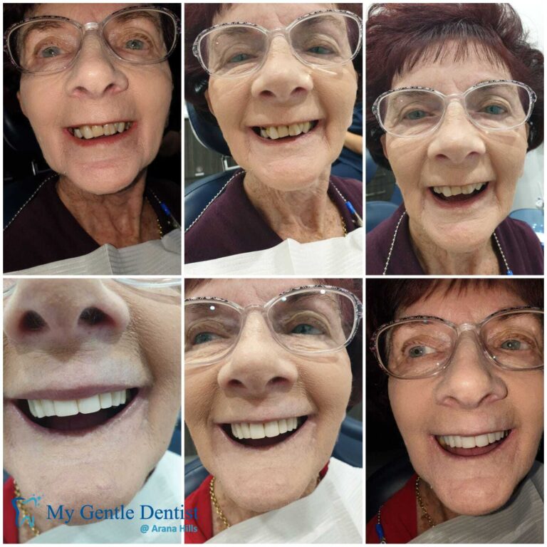 Default Title
