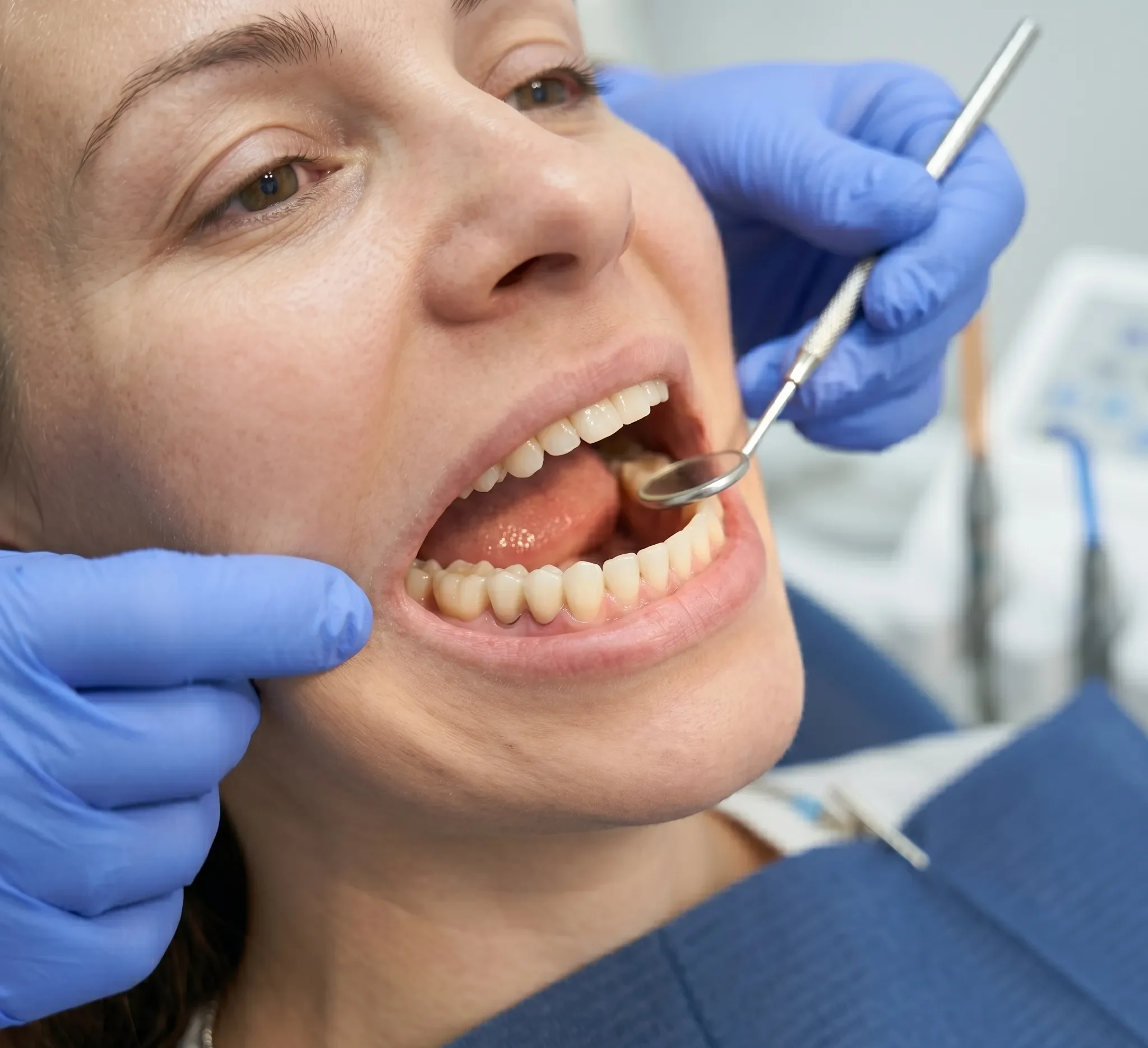 Fixed Teeth on Implants Fixed Teeth on Implants